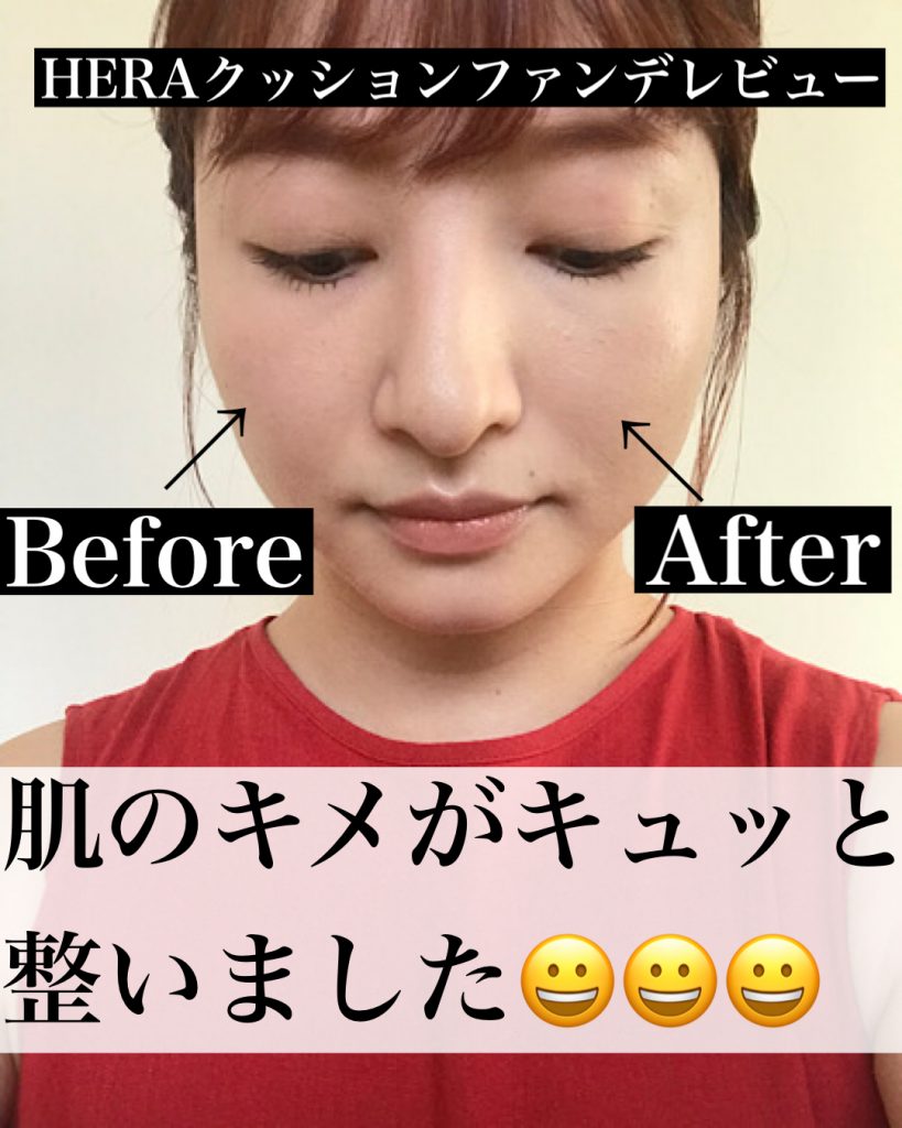 ビフォーアフター写真